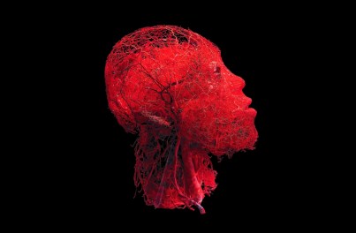 Look at the amazing web of blood vessels inside a human head!